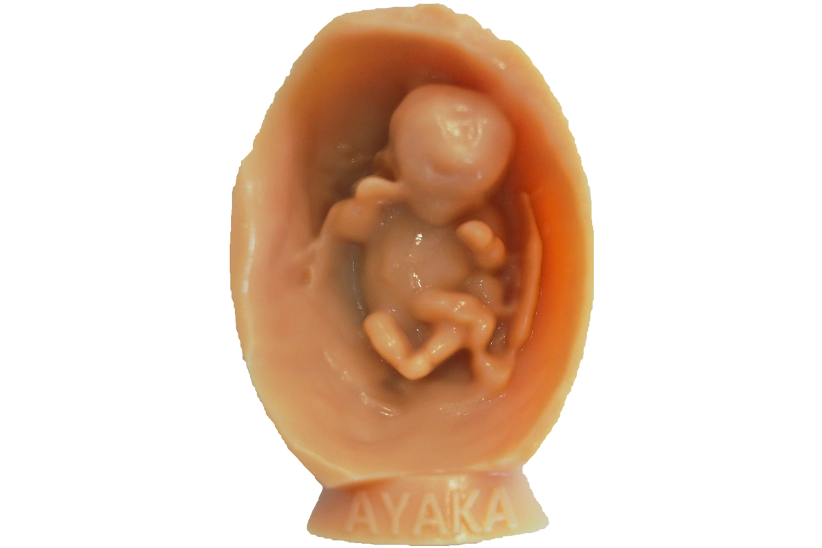 胎児a1